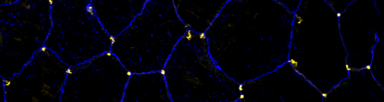 Tricellular Junctions