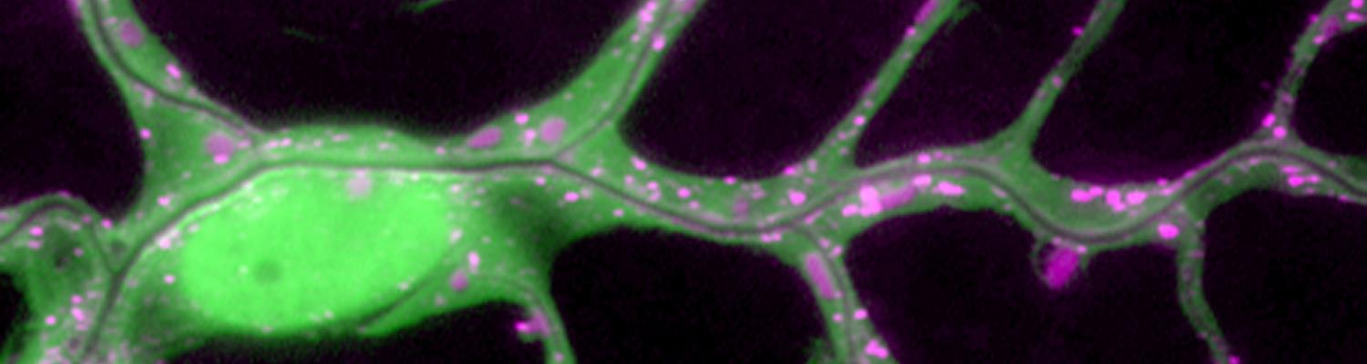 Subcellular Lumen