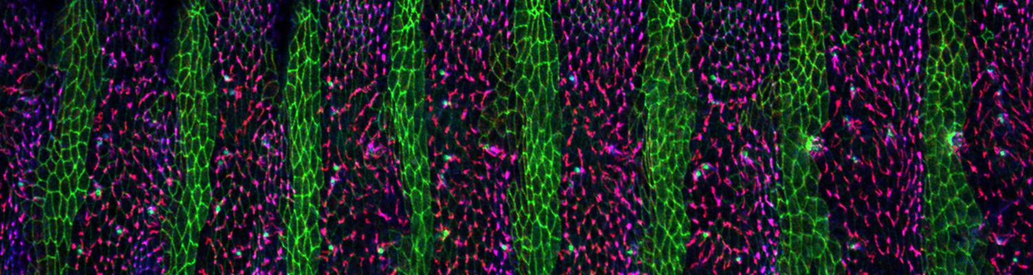 epidermal stripes
