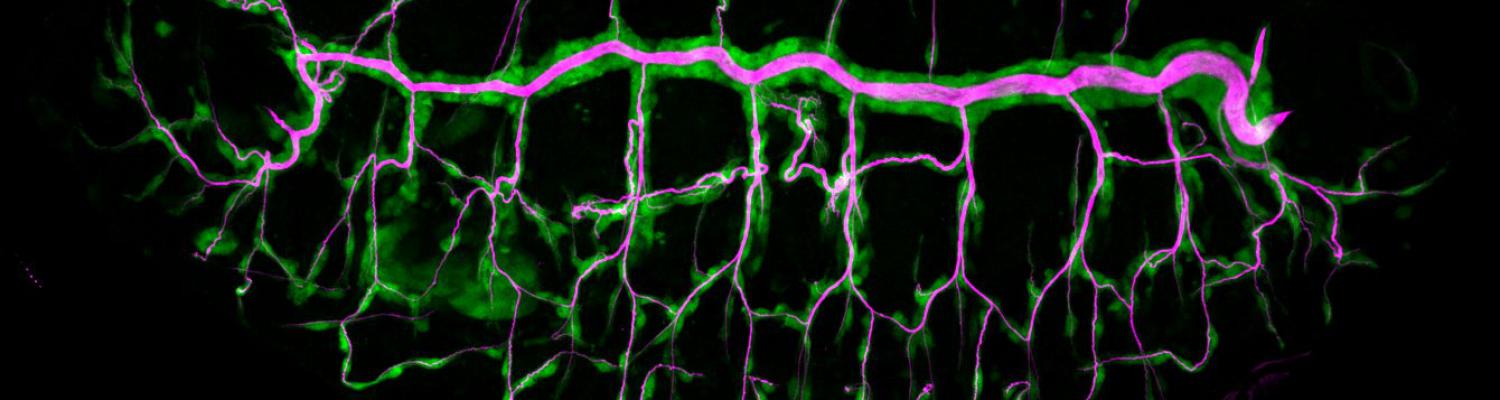 Tracheal System of a Fly Embryo